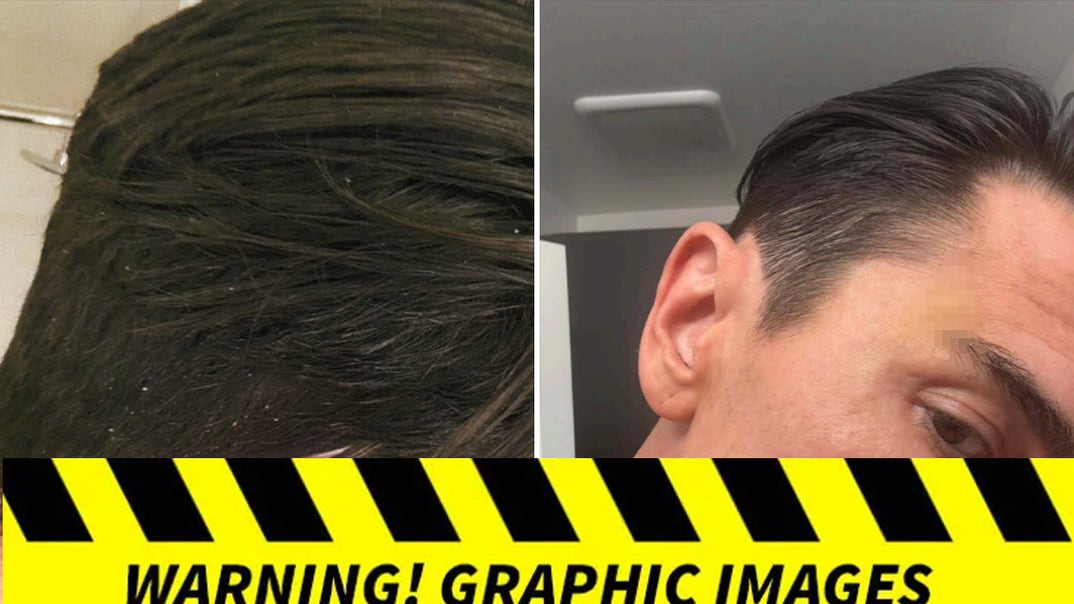 0625-Tom-Sandoval-Injuries-PRIMARY