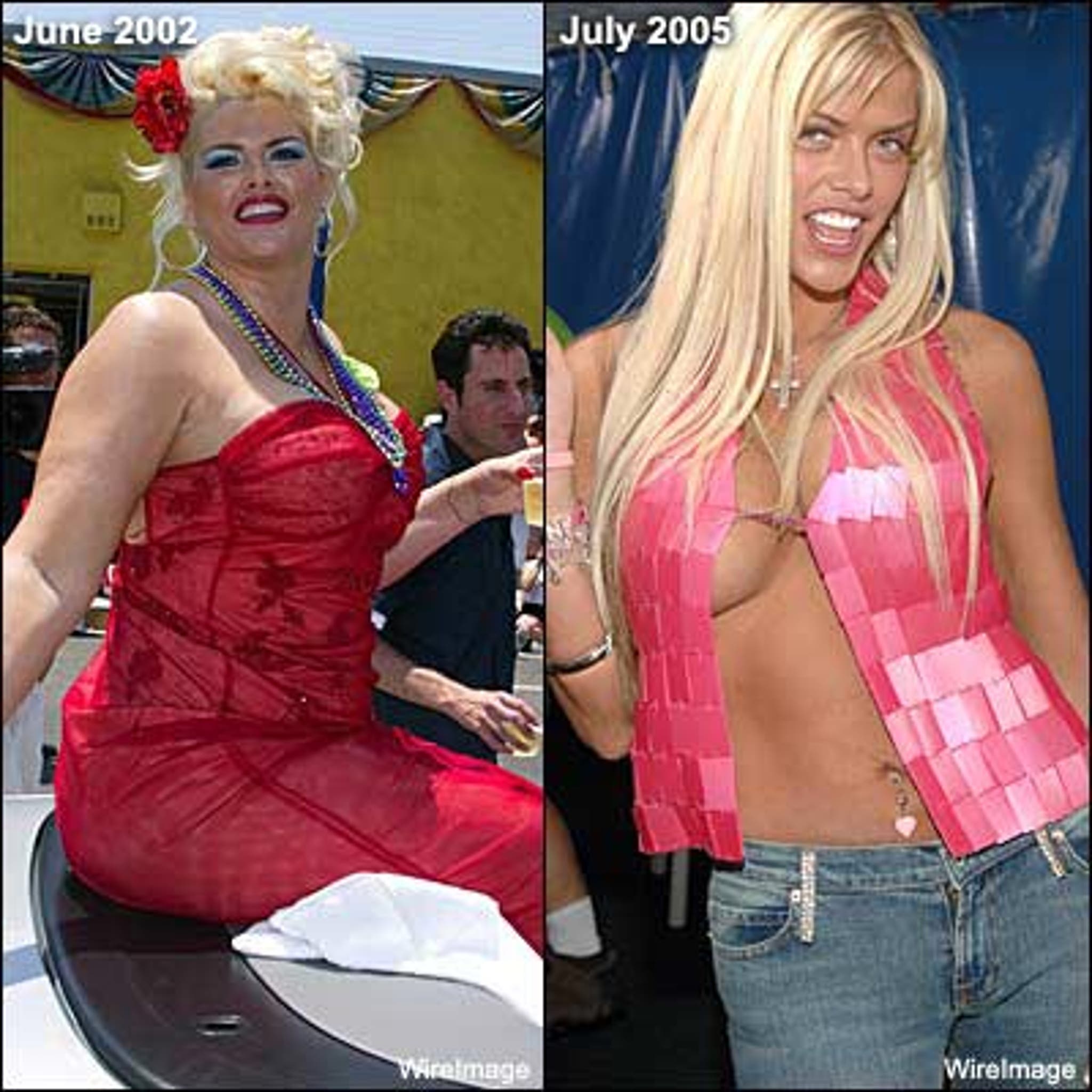 Most Radical Celebrity Weight Changes - Anna Nicole