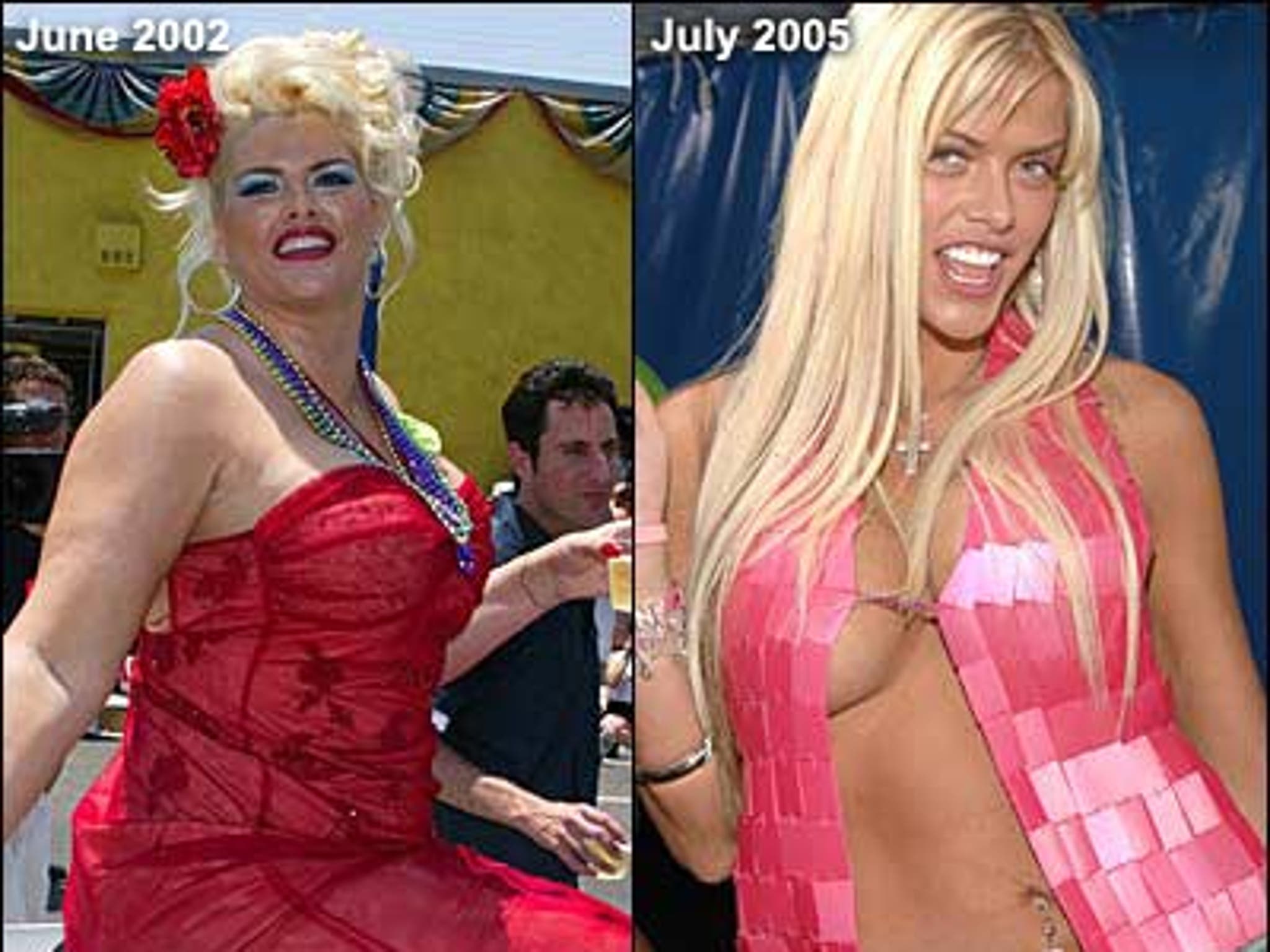 anna nicole smith before and after weight loss