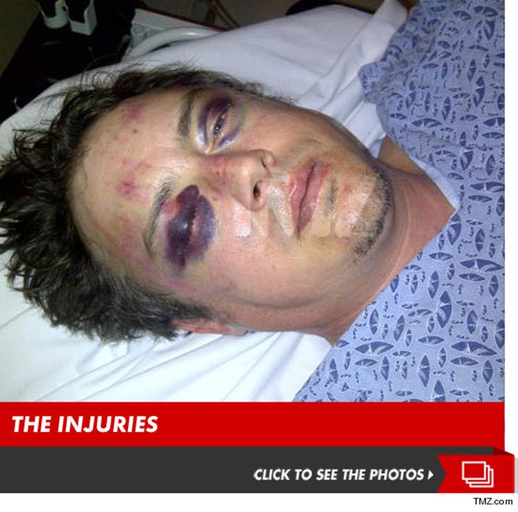Jason London -- I'm the REAL Victim ... They BROKE My Face