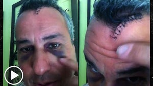 'Sell This House: Extreme' Star -- Mirror, Mirror ... Smashed Me In the Face