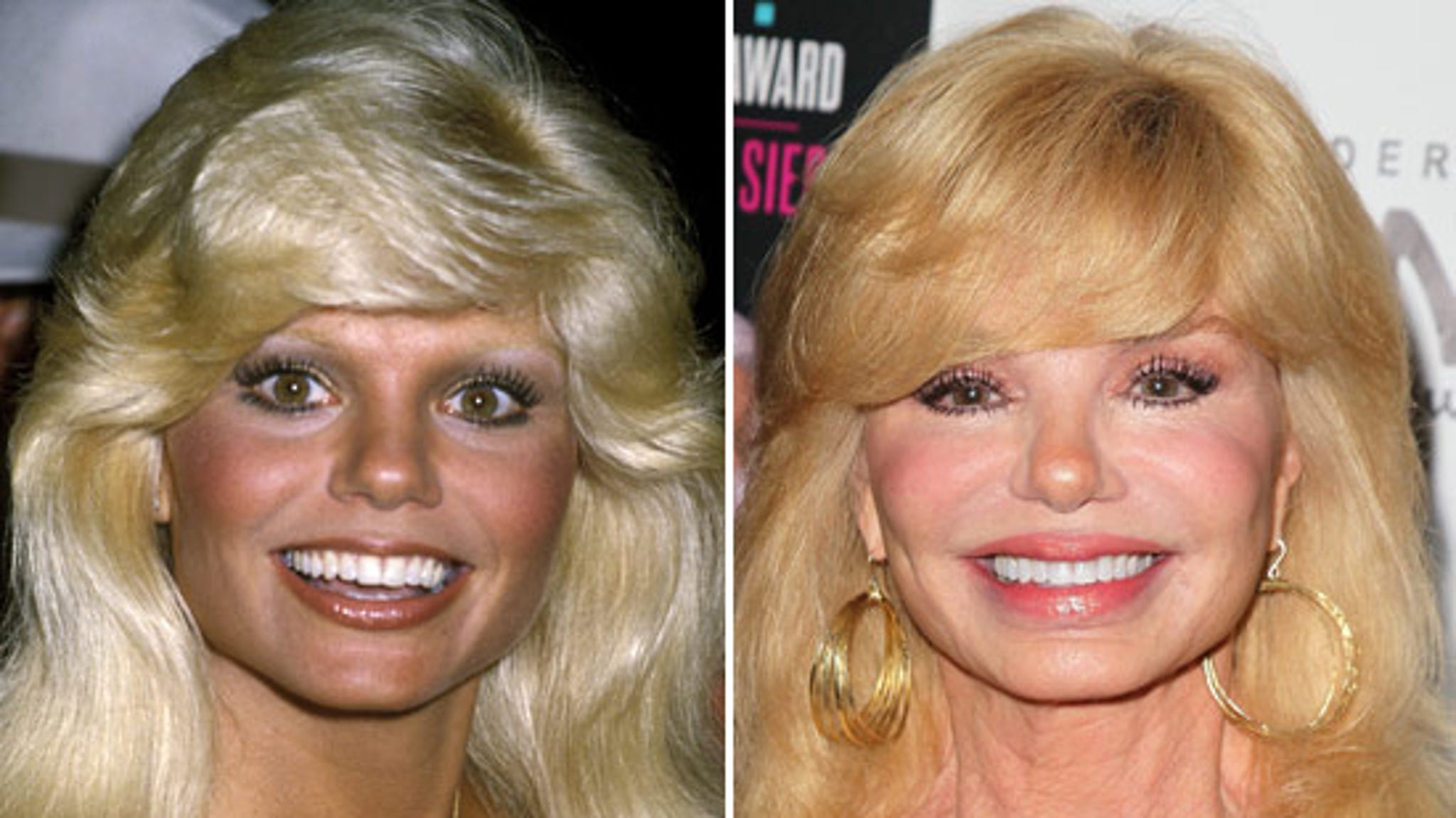 Loni anderson plastic surgery