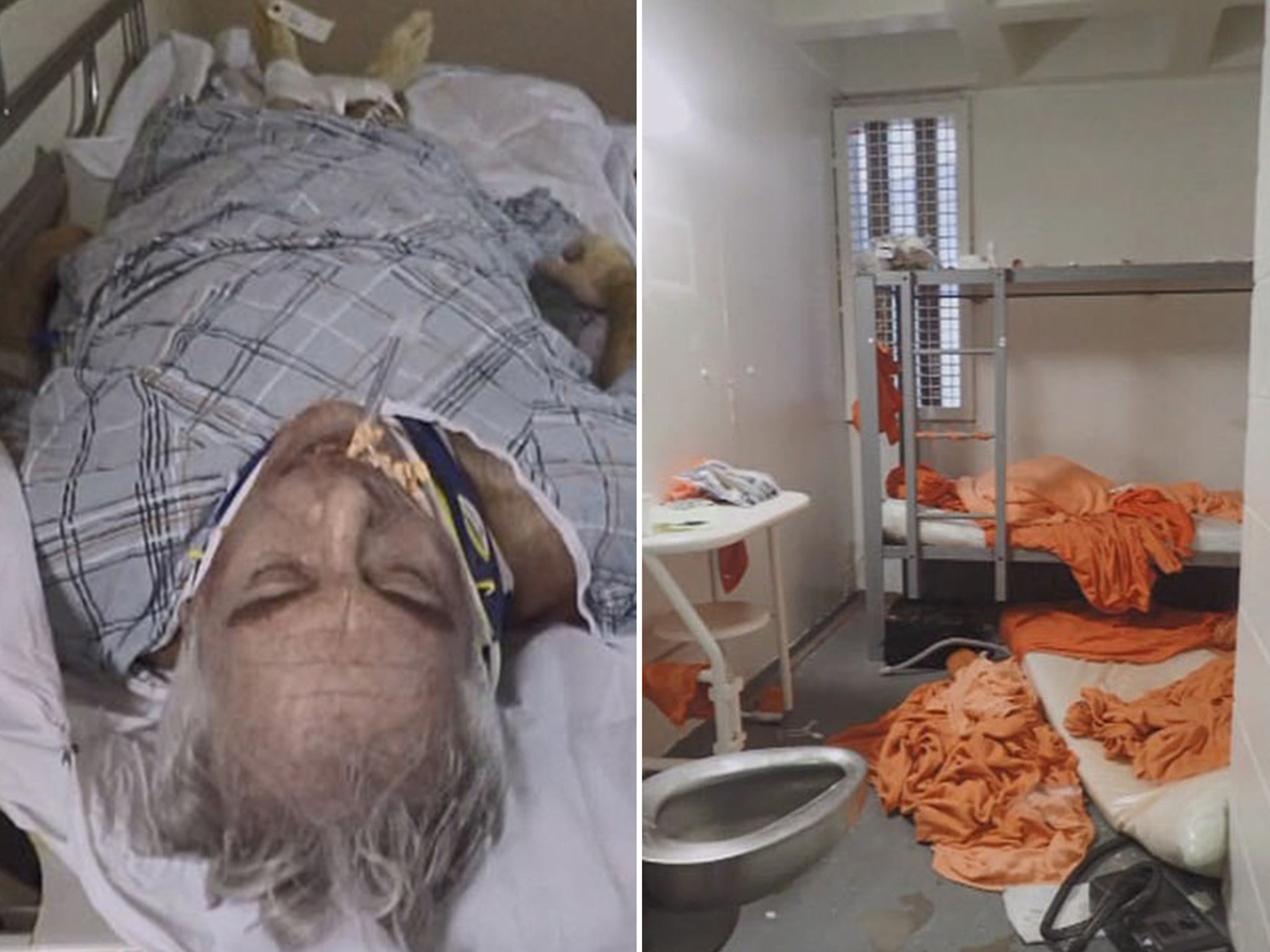 Jeffrey Epstein's Gruesome Autopsy Photos, More Suicide Questions Raised