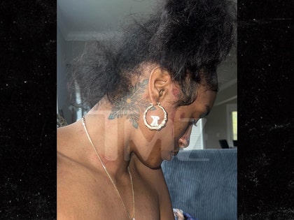 kylie frost alleged injuries by t hood tmz 1