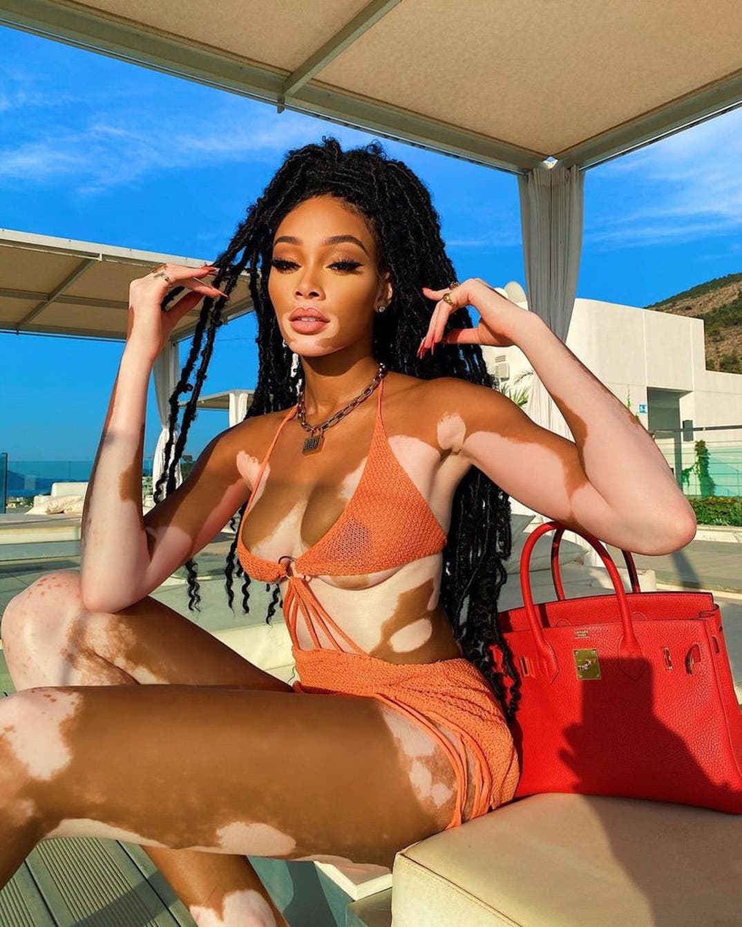 0726 Winnie Harlow Hot Shots 1