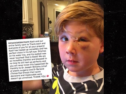 0509-kim-zolciak-kash-dog-bite-eye-photo-INSTAGRAM-with-caption-01