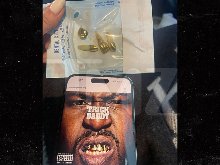 Tricky Daddy -- Gets 30 Year Old Gold Teeth Taken Out