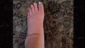 Jessica Simpson's Foot Swells Like a Balloon During Pregnancy, 'Help!'