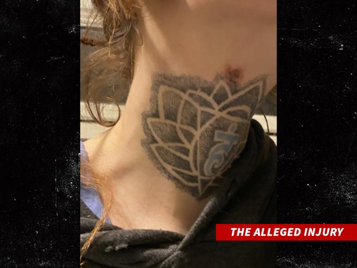 Crispin-glover-presunta-lesión-sub-1