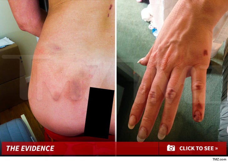 Ariane Bellamar's Injuries -- The Photo Evidence