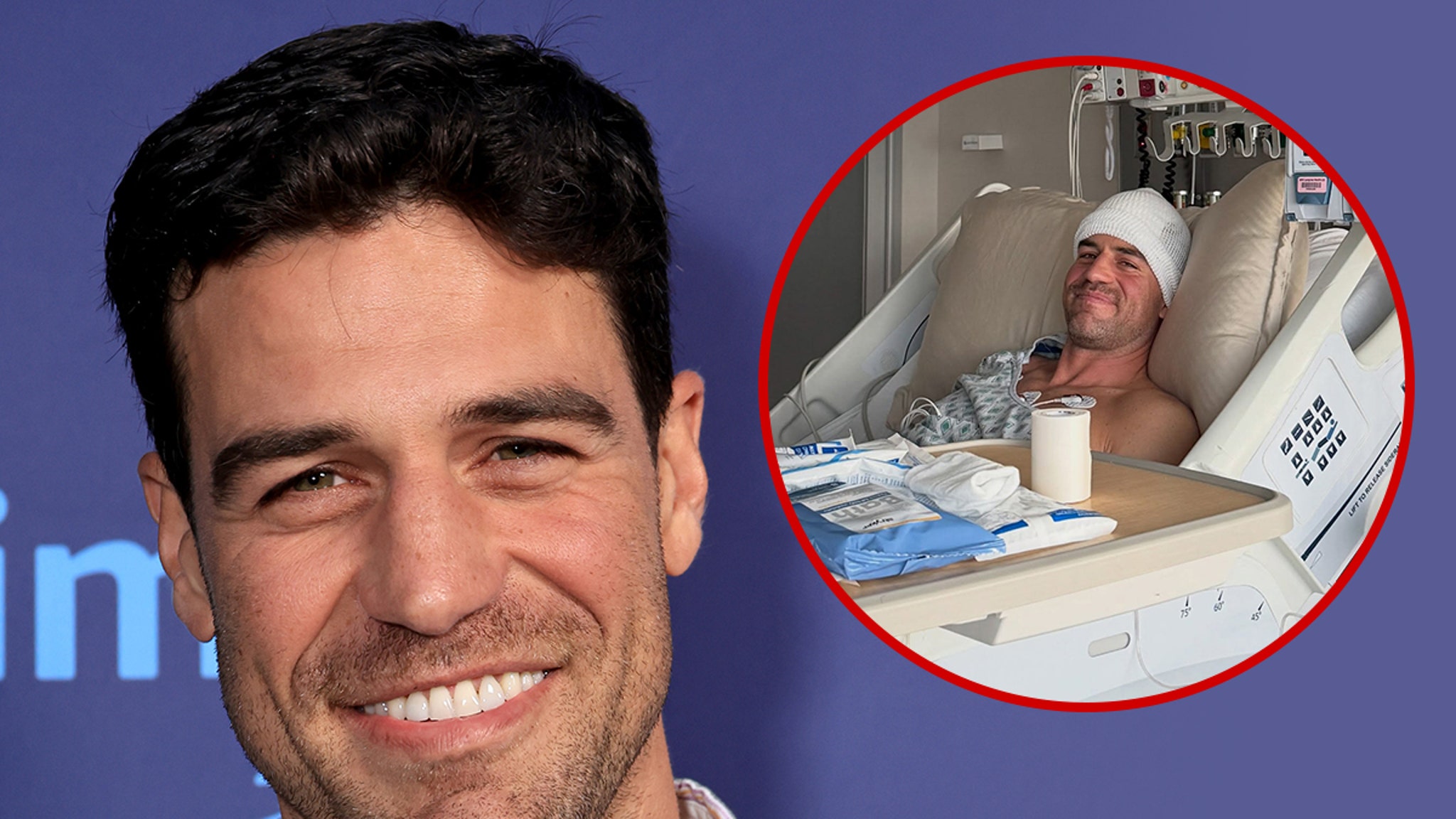 'Bachelor in Paradise' Alum Joe Amabile Has Brain Tumor Removed