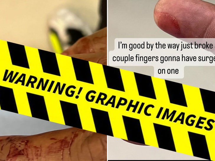 Paul Pierce Suffers Gruesome Finger Injury