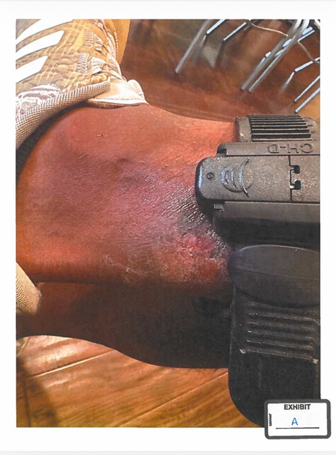 Patrick Mahomes Sr. Injury Pics 0