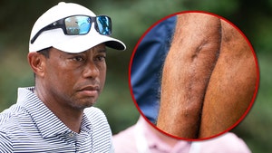 TIGER WOODS LEG SCAR