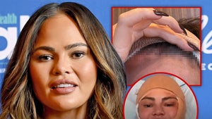 chrissy teigen surgery head stitches main getty instagram composite