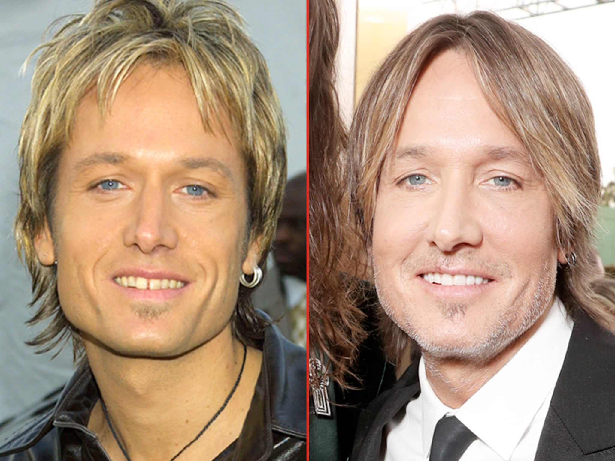 Keith Urban -- Good Genes or Good Docs?!