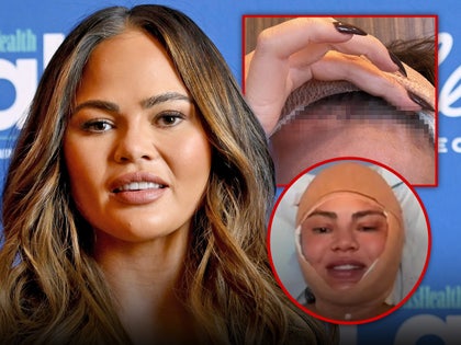 chrissy teigen surgery head stitches main getty instagram composite