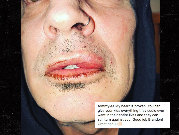 Tommy Lee's Son Allegedly Lost Control and Knocked Him Out Cold, Fiancee  Feared He was Dead