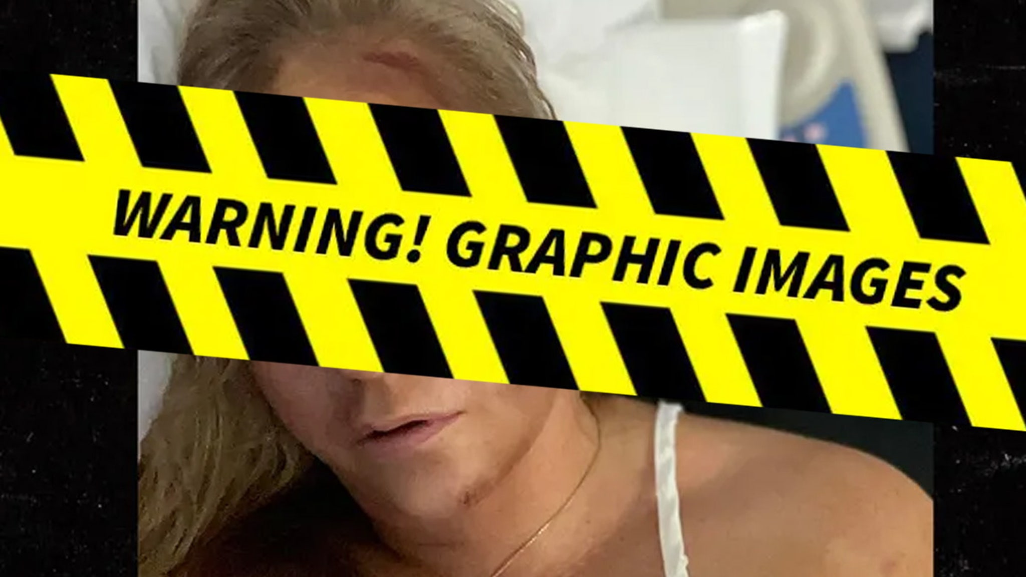 Virginia Giuffre Car Crash Injury