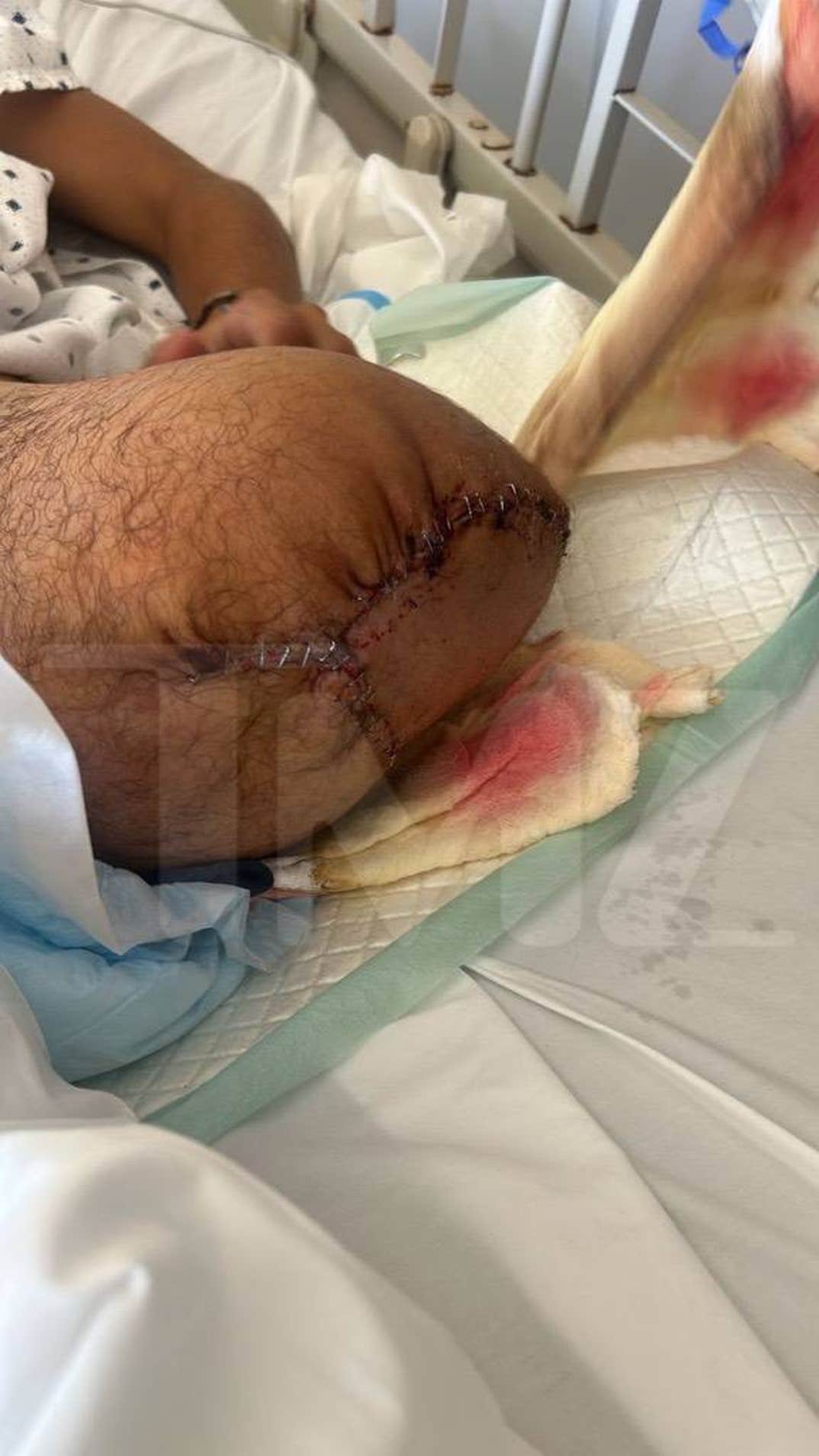 Survivor Greece Contestant Stavros Floros Incident 7