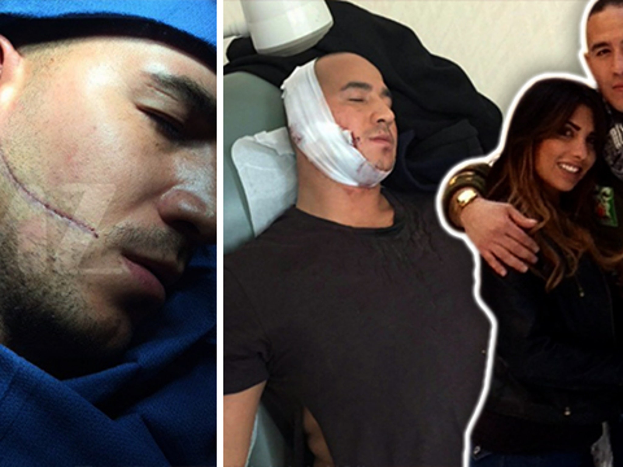 “Mob Wives” Guy Gets 250 Stitches!