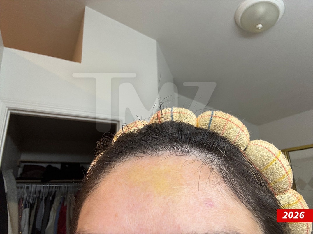 Dakota-Mortensen-Alleged-Injuries-Swipe- 1