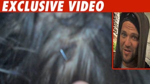 Bam Margera -- Check Out My Bloody, Stapled Head