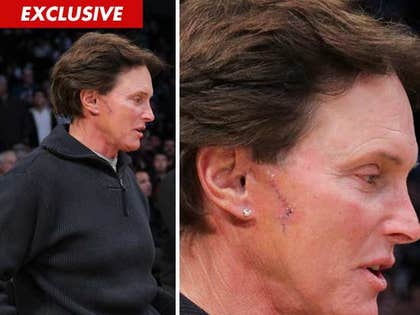 0117_bruce_jenner_EX_01