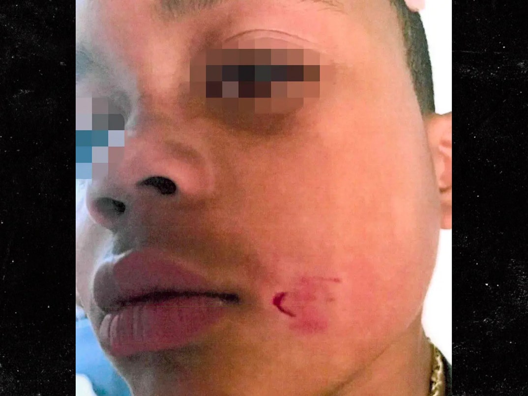 aaron donald kids dog bites 2