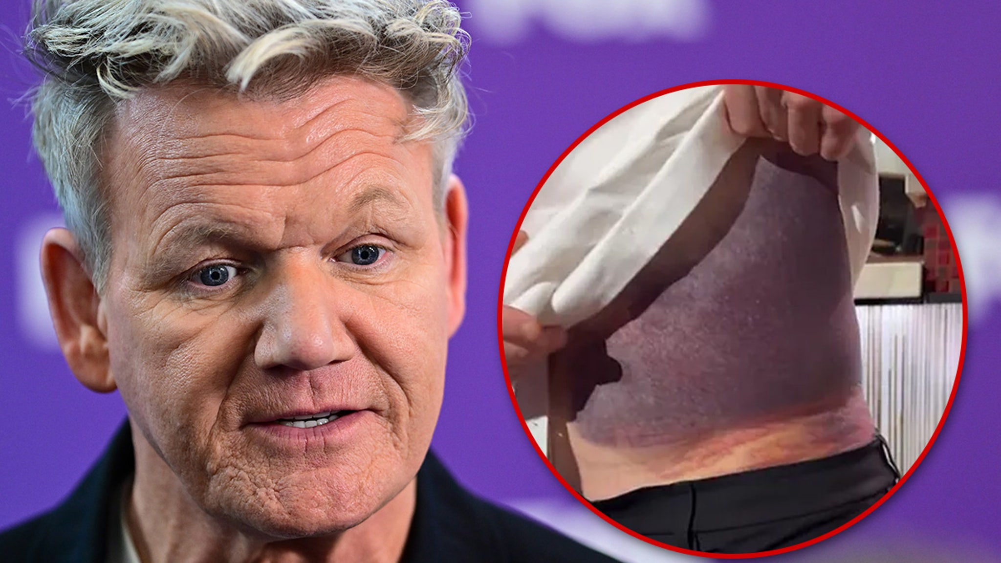 Gordon Ramsay Details Bloody, Painful Aftermath of Bike Crash