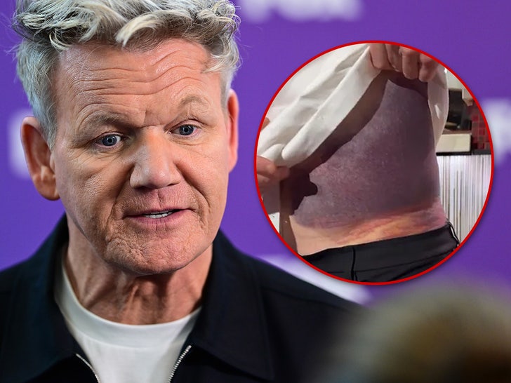 Gordon Ramsay Details Bloody, Painful Aftermath of Bike Crash