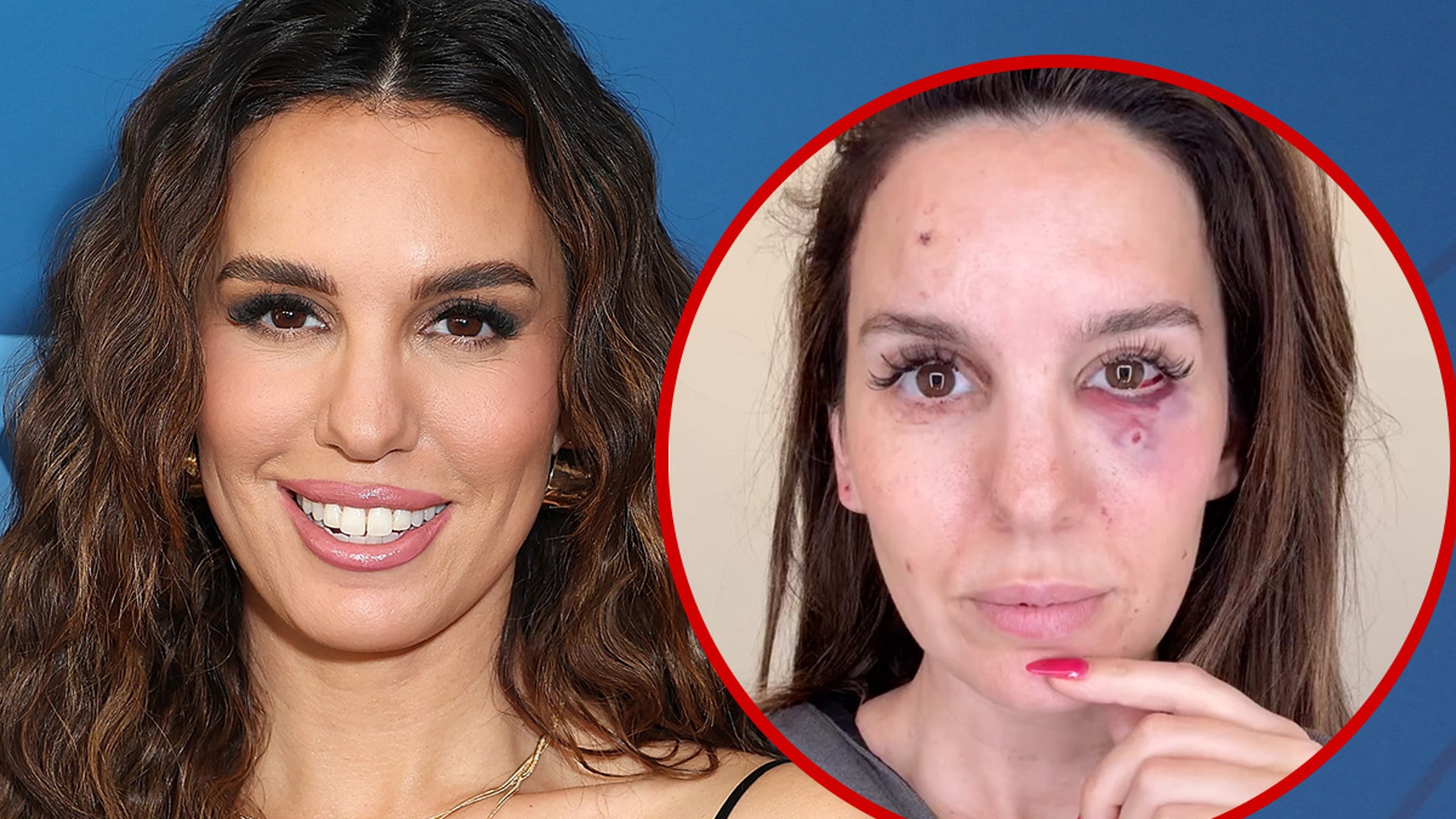 Christy Carlson Romano Says She Was Shot In Face While Shooting Clay Pigeons