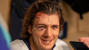 NHL's Morgan Barron Shows Off Nasty Scar After Taking Skate To Face