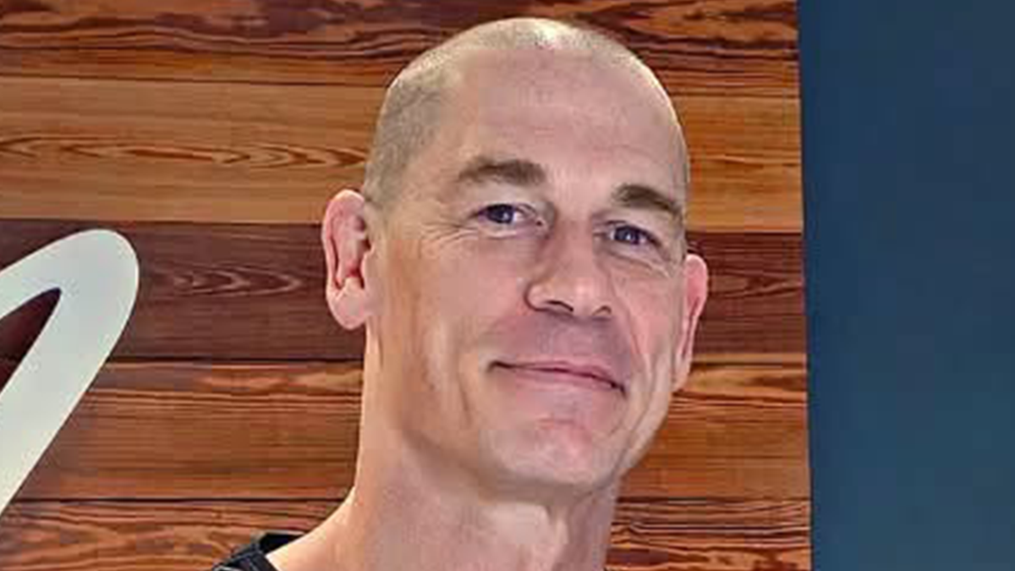 Cena Shaves Head For Another Hair Transplant!