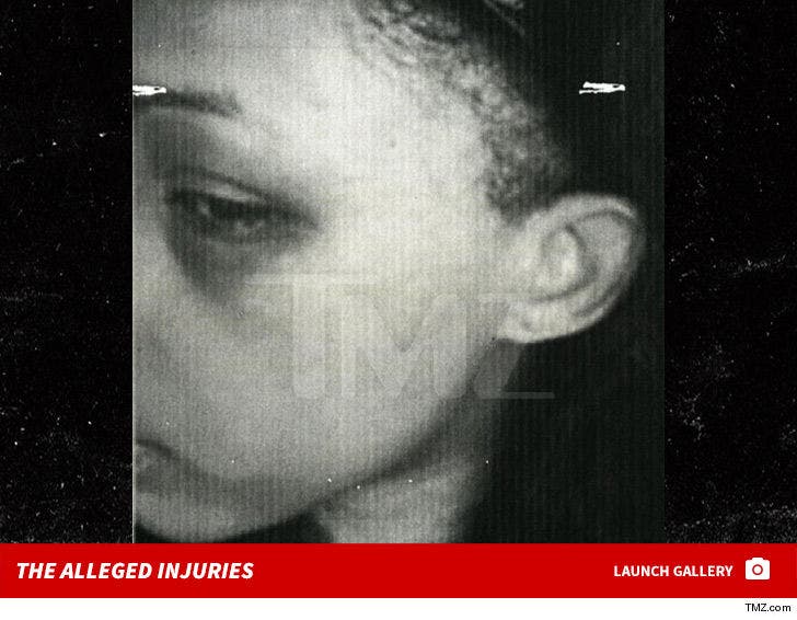 Rich the Kid -- The Alleged Injuries