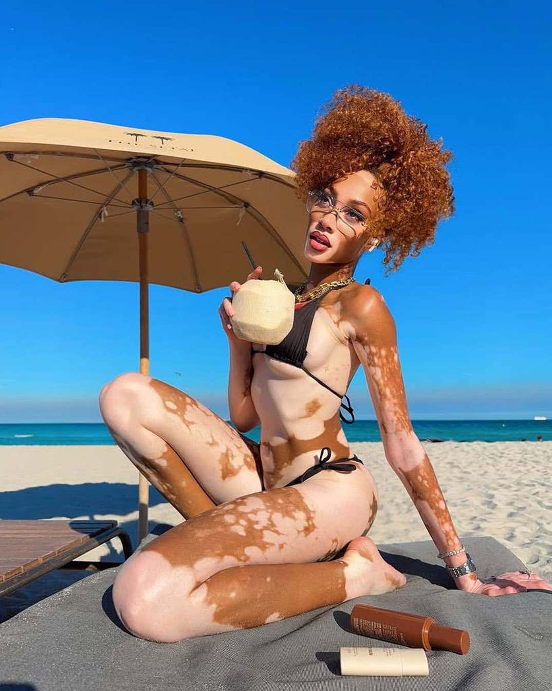 Winnie Harlow