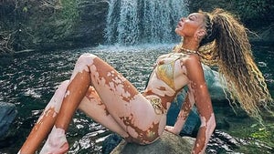 0717-Winnie-Harlow-Hot-Shot-PRIMARY