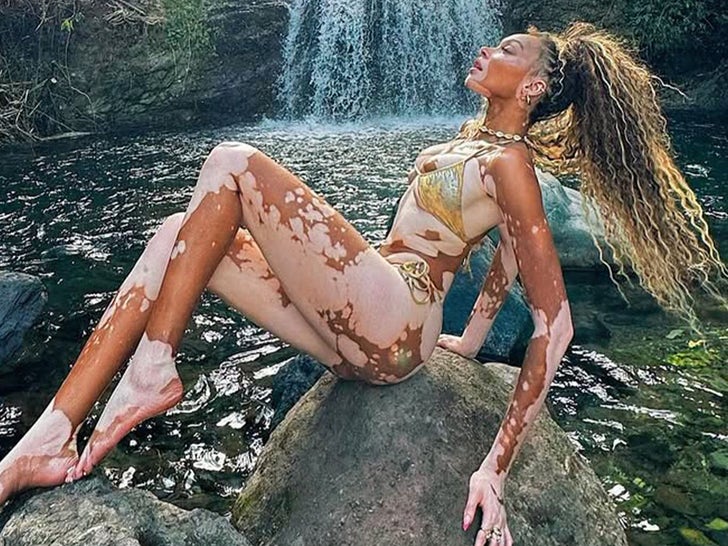 Winnie Harlow Hot Shots