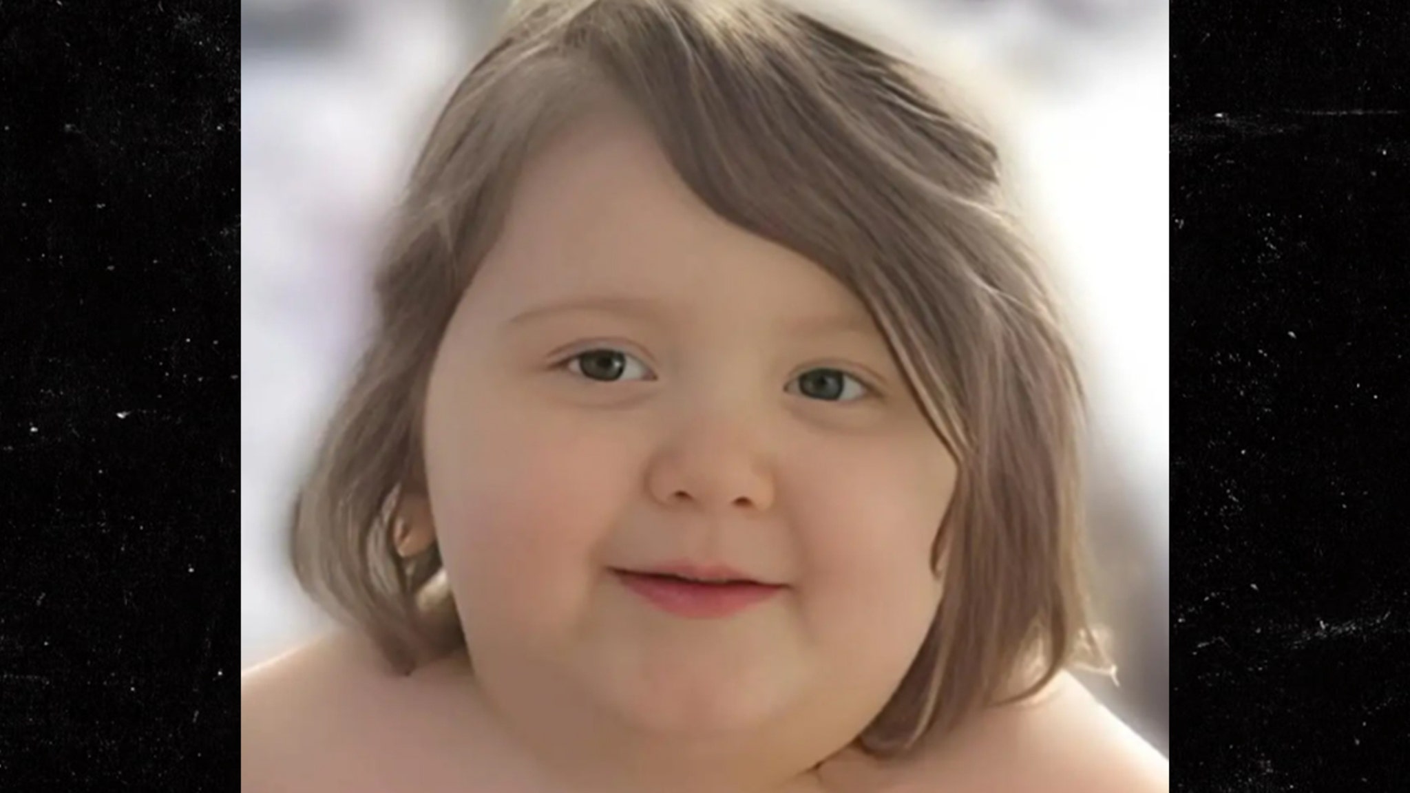 Parents Face Murder Raps After Child Dies From Extreme Obesity