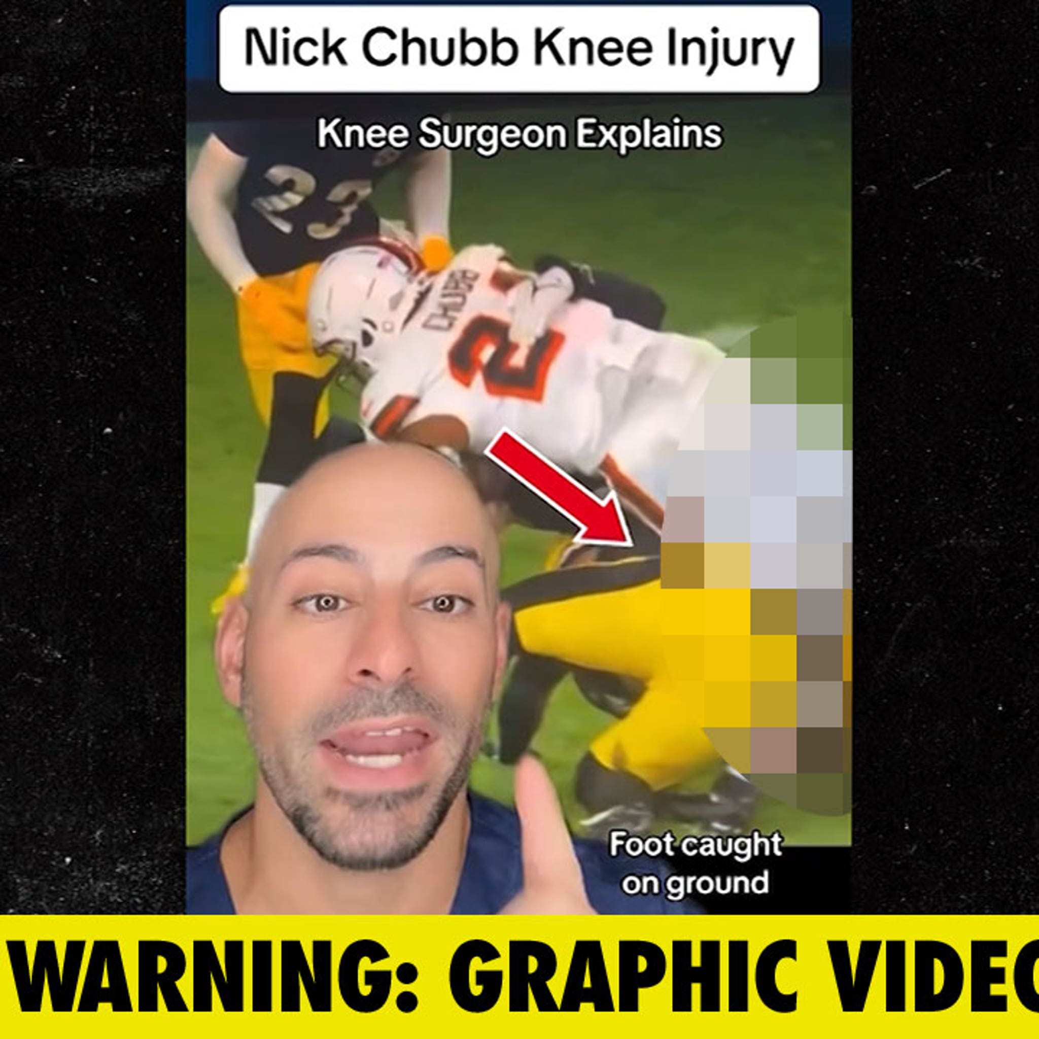 Nick Chubb injury: Surgeon claims NFL career could be over as disturbing  image emerges - The Mirror US