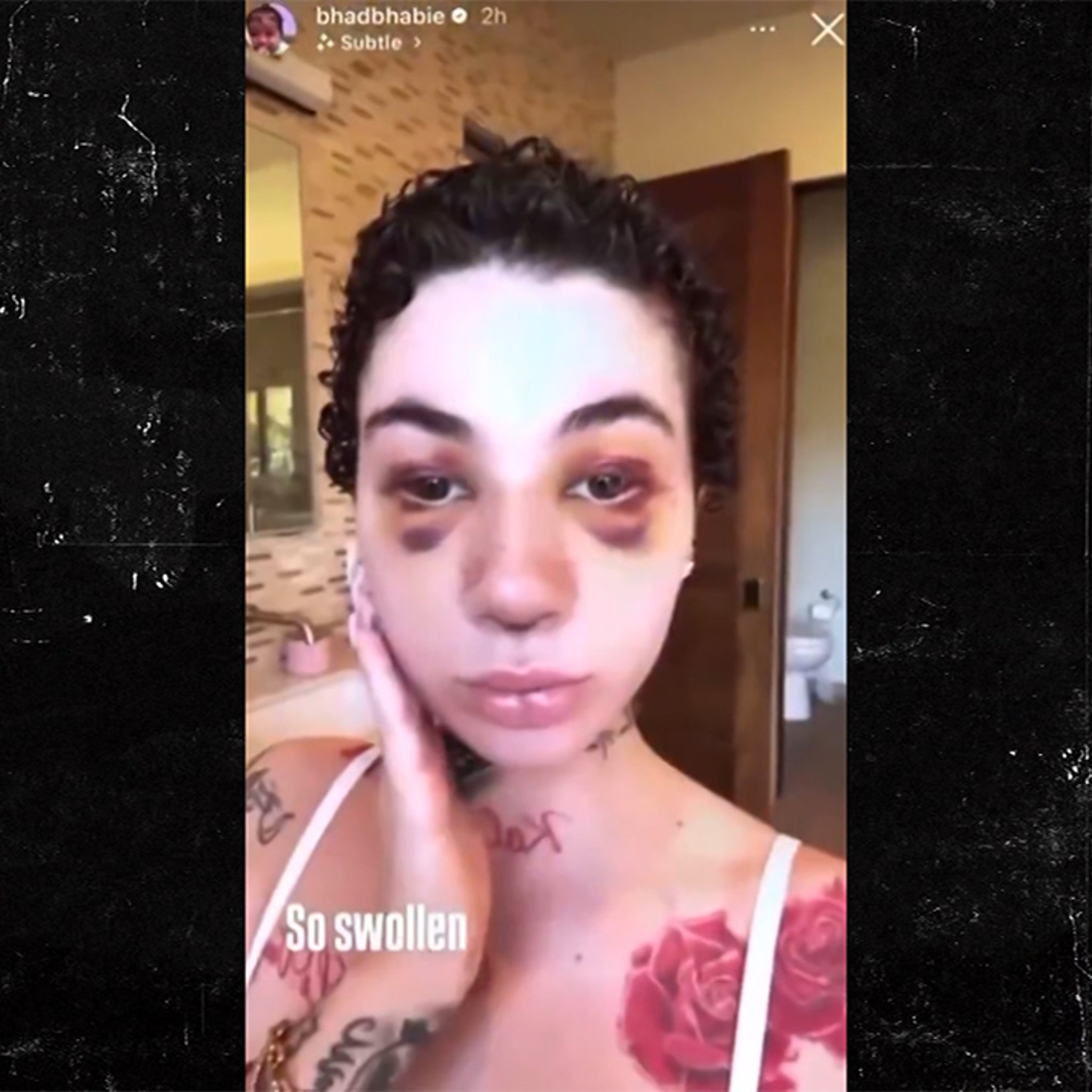 Bhad Bhabie Reveals New Nose Post-Surgery After Blood Cancer Diagnosis