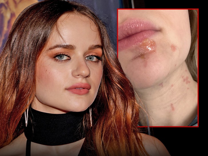 joey king oil injury main getty instagram composite