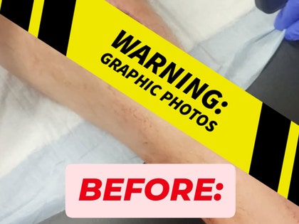 wonderboy-injury-gallery-launch-ig-1
