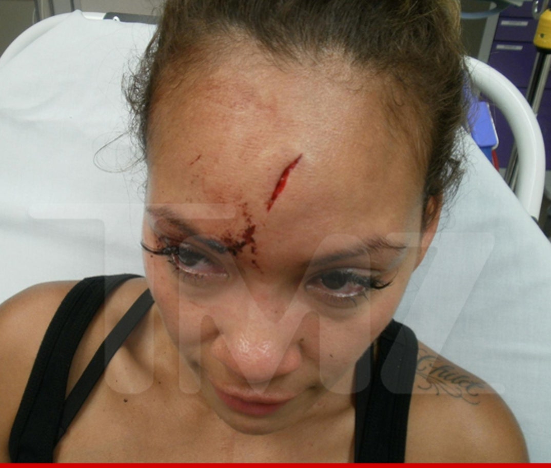 Evelyn Lozada's Injuries, image size:1074x912