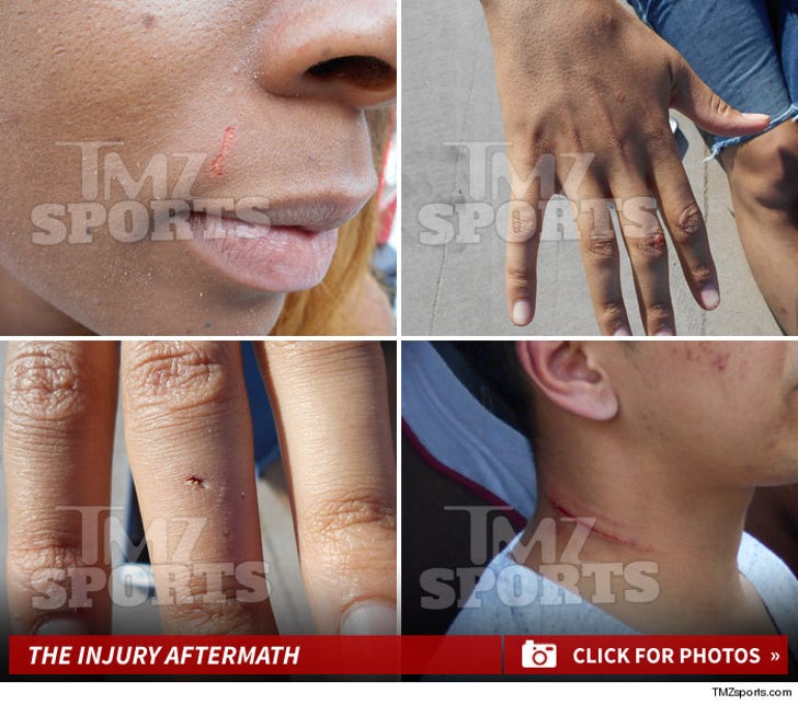 Brittney Griner & Glory Johnson -- The Aftermath Injuries
