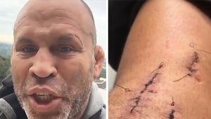 MMA's Wanderlei Silva -- Stitches, Scars, Broken Helmet ... After Brazil Hit & Run (VIDEO)
