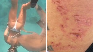 Nurse Shark Attacks Snorkeler Who Cleans Wound and Jumps Back in Ocean in Maldives
