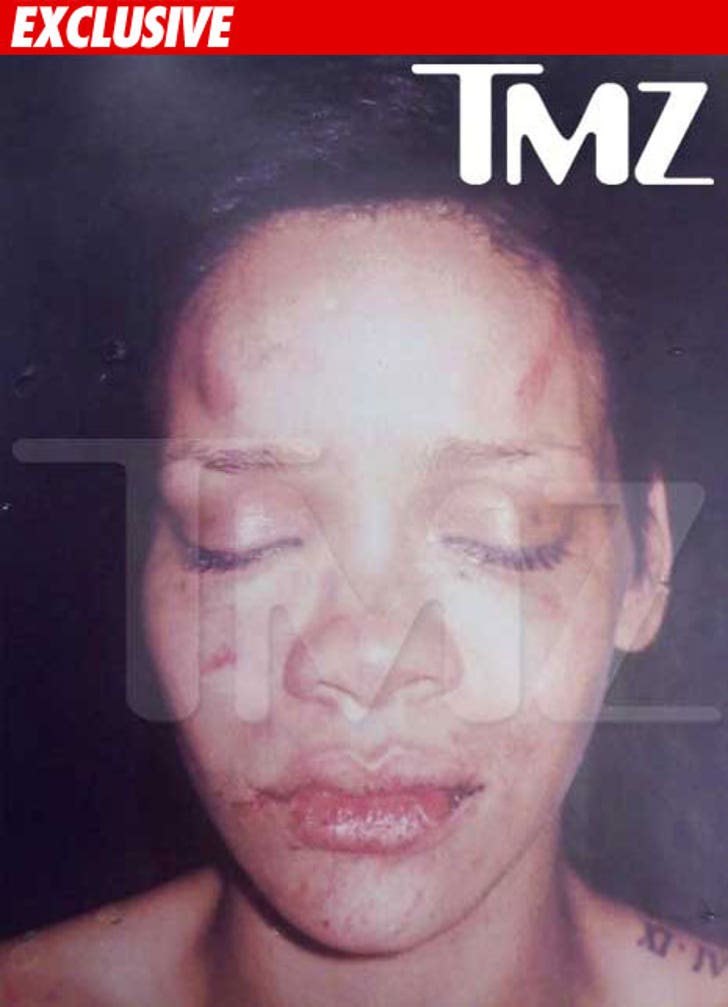 Rihanna -- The of a Woman Abused by Chris Brown