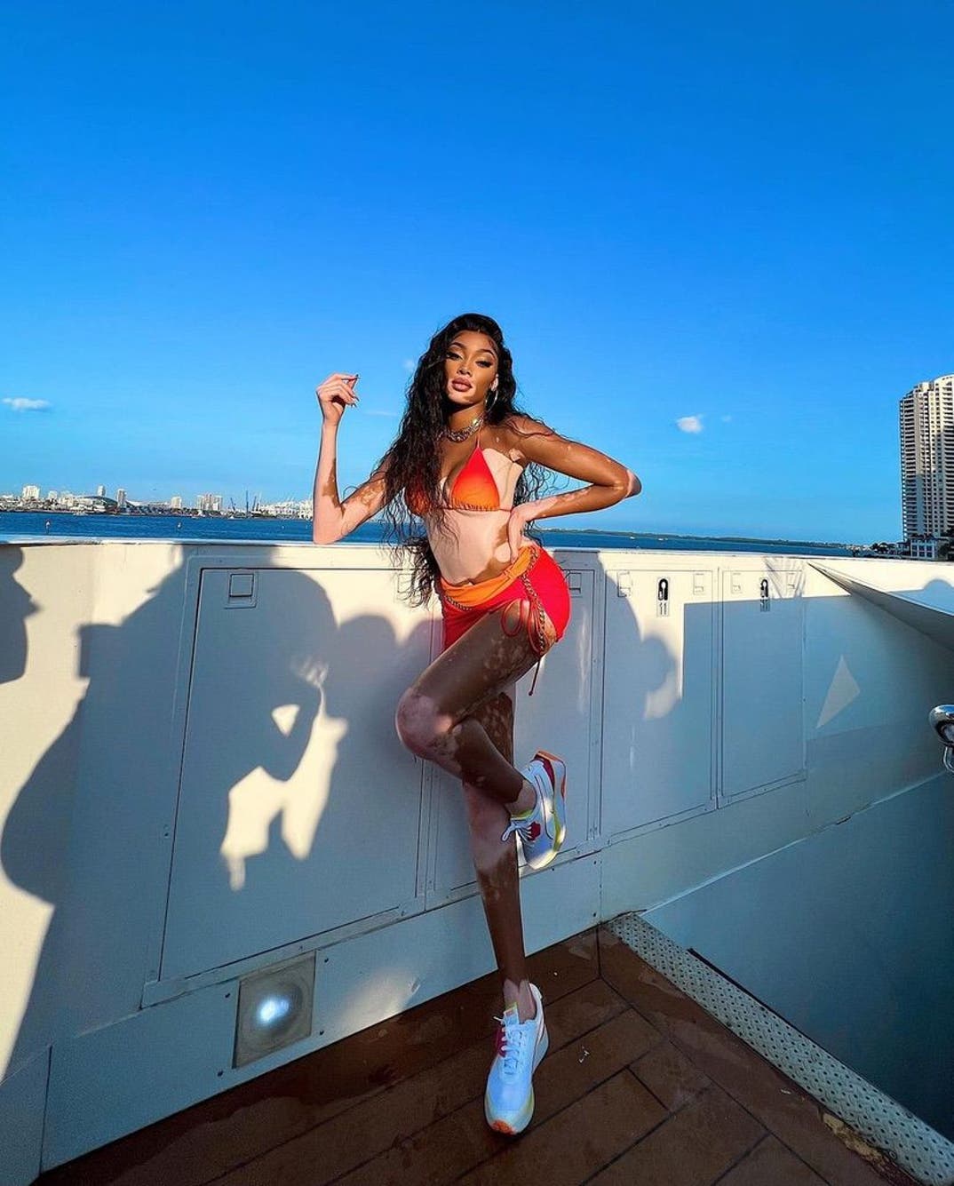 0726 Winnie Harlow Hot Shots 7