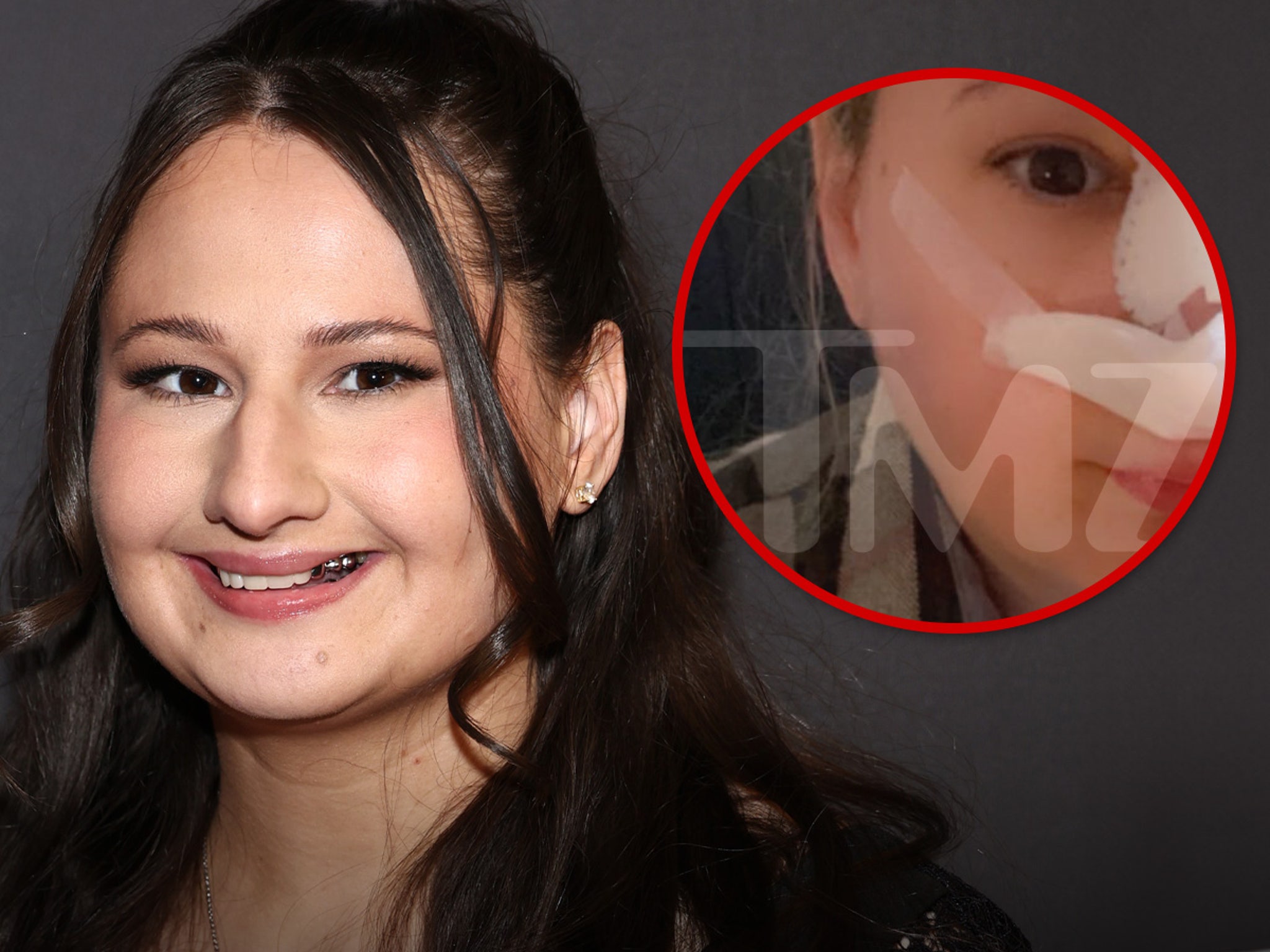 Gypsy Rose Blanchard Recovering in First Look After Nose Job